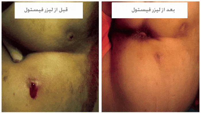 عکس قبل و بعد از جراحی