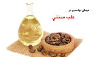 درمان بواسیر یا هموروئید در طب سنتی از طریق سودا زدایی