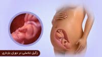 تاثیر زگیل تناسلی بر جنین در دوران بارداری و زایمان و درمان زگیل تناسلی در بارداری