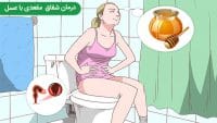 درمان شقاق مقعدی با عسل از روش های طب سنتی درمان شقاق