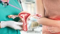 عفونت HPV و زگیل تناسلی منجر به سرطان دهانه رحم