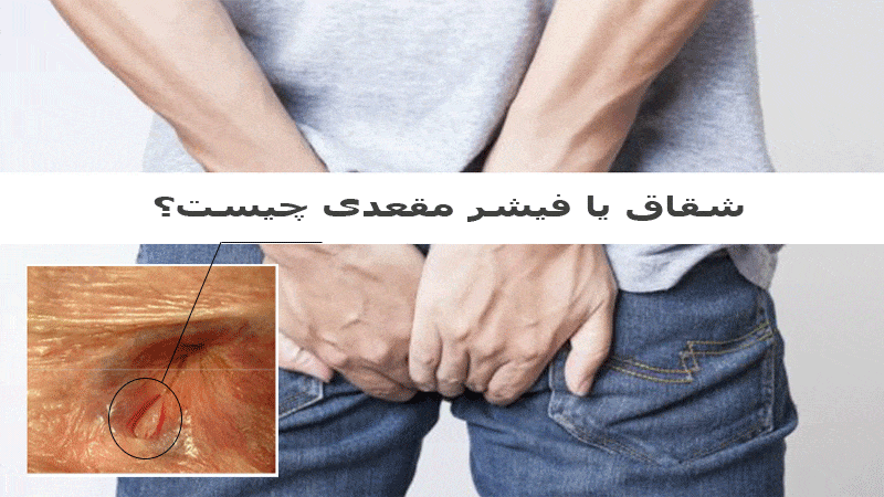 شقاق چیست