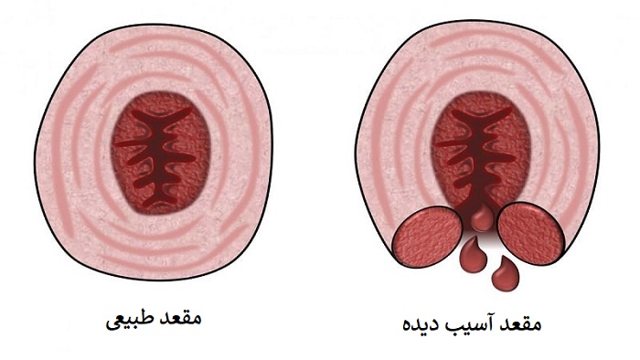 عکس مقعد سالم